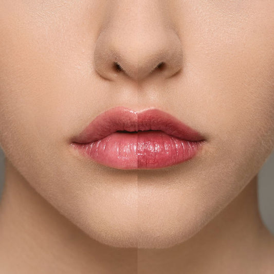 Supreme Lip Treatment | Himbeere